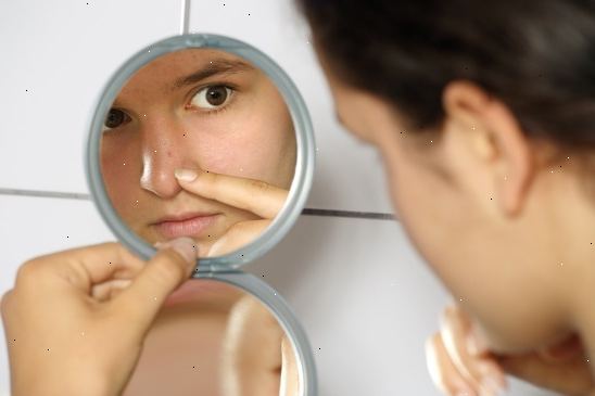 8 nemme hjem retsmidler mod acne