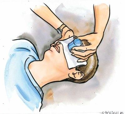Førstehjælp tips til fire almindelige øjenskader. Hvad man skal gøre ved øjet nedskæringer og stiksår.
