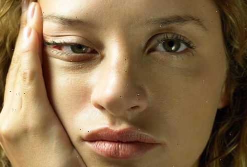 Hvad er årsagen til kronisk træthedssyndrom?